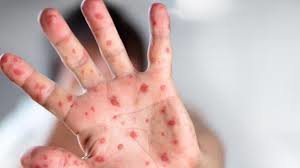  ������ ������ ���� �������� ����� 250 ������� 