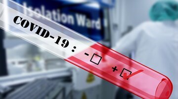  ������ ���� ������ ��������� covid-19 ����� ����� ��������� 