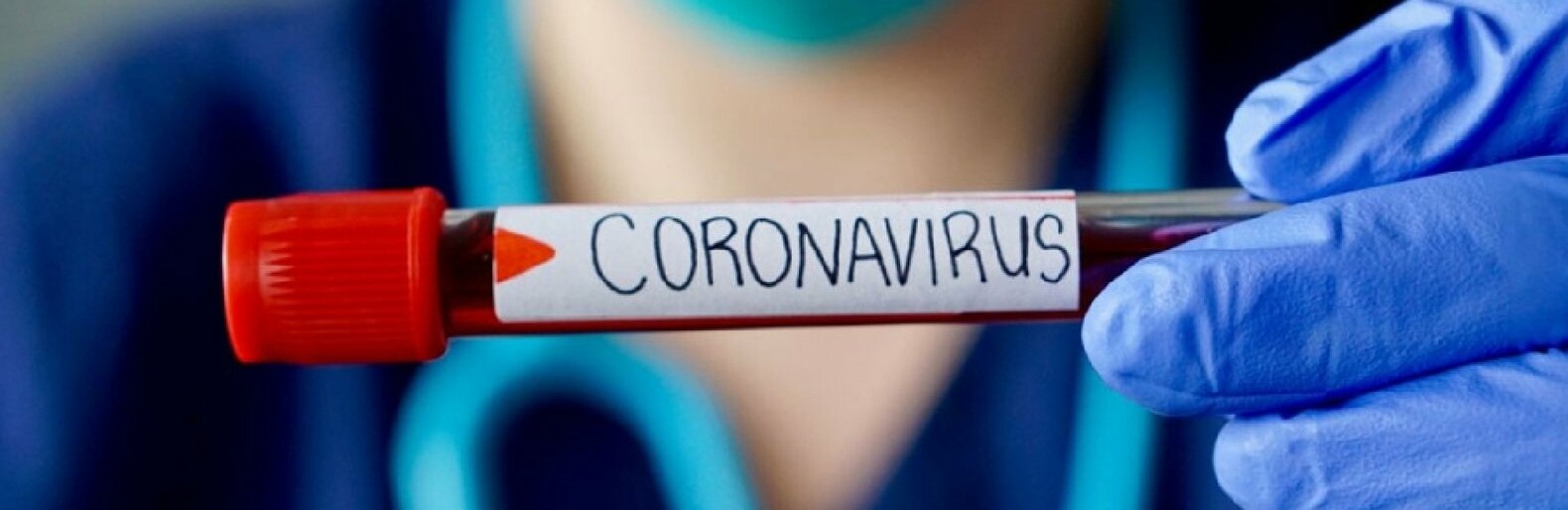  ������� ������������� 218 ������� �������������� ������� covid-19 