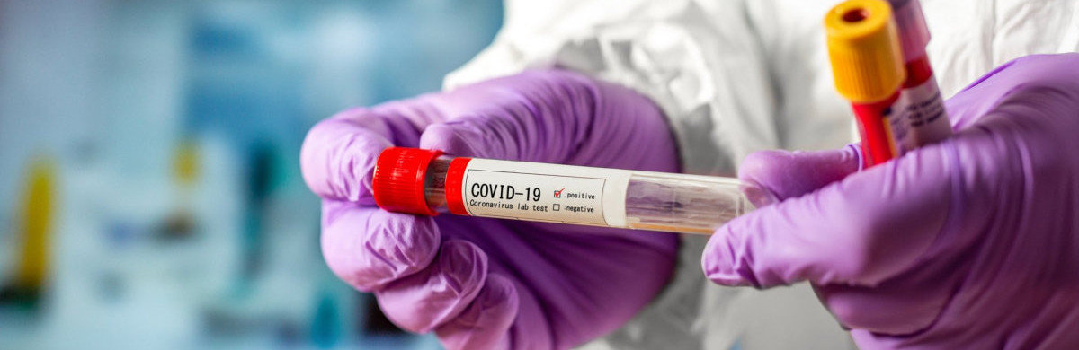  ������� ������������� 1308 ������� �������������� ������� covid-19 