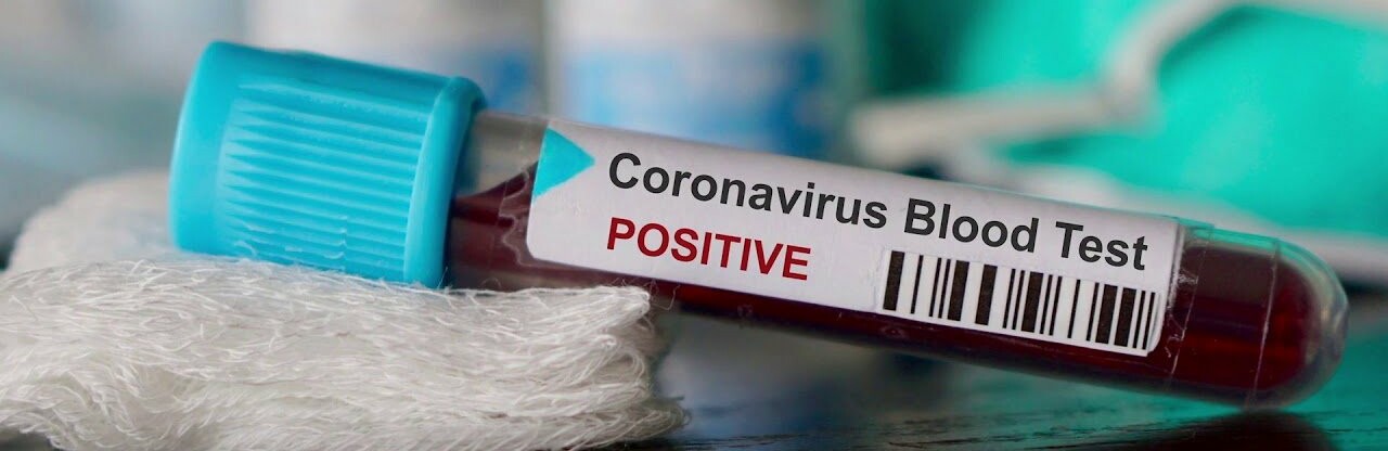  �������� ����� ������� ������������� 856 ������� ����������� covid-19 