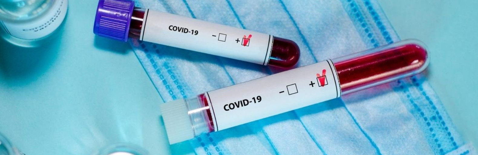  ������ ����� ����� ������� covid-19 ������ ������� ������� 