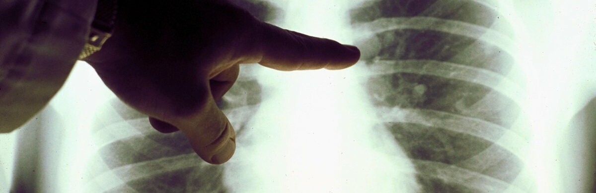  ������� ������ ������ ���� ����������������� ������������� ���������� 