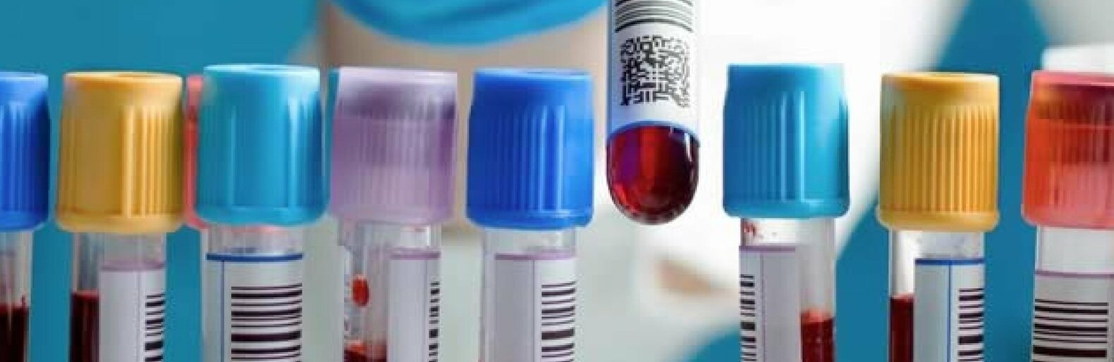  �������� ����� ������ ���� ������ �������� covid-19 