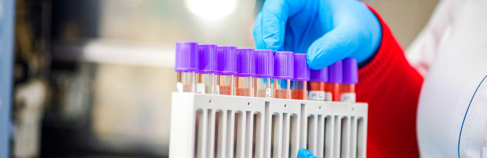  �������� ����� ������ ���� ������ �������� covid-19 