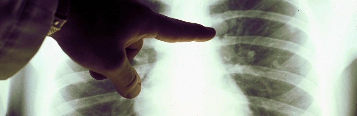  100 ���������� ����������������� ����� ���������� 