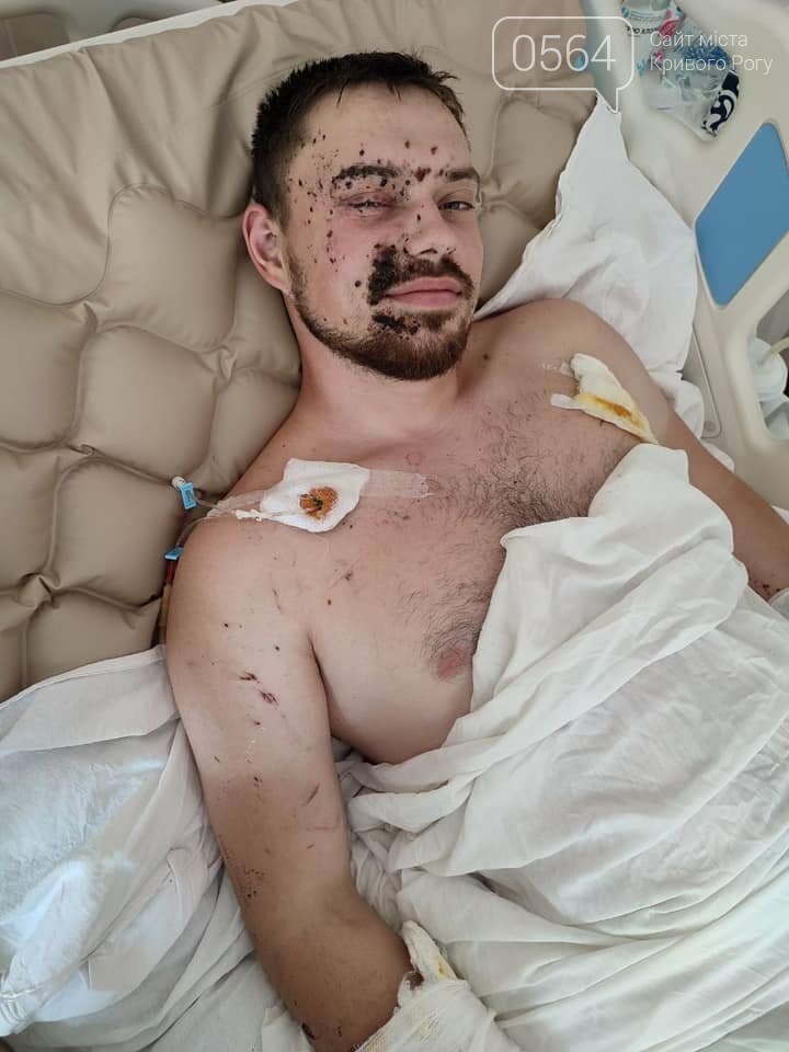 При выполнении боевой задачи на Донбассе ранен криворожанин Борис Басс. Нужна помощь в лечении, - ФОТО, фото-3