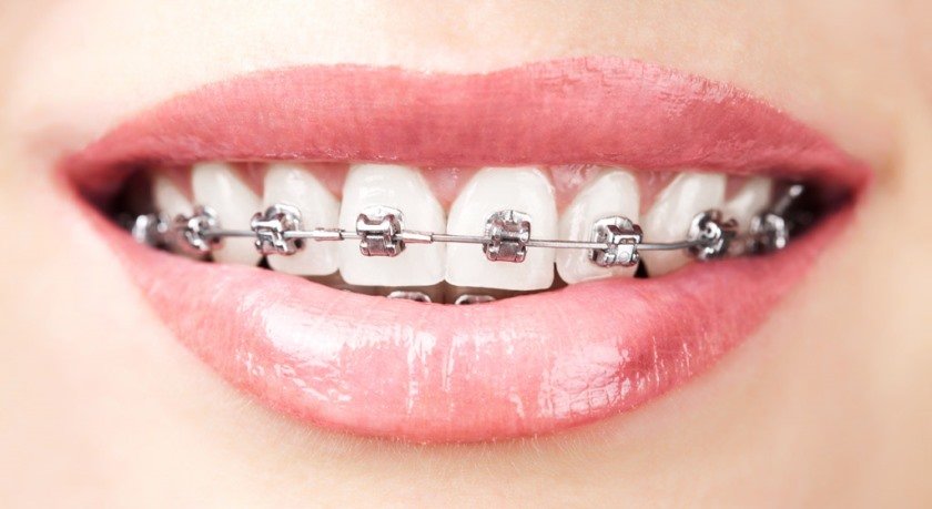Ортодонтична стоматологія, фото-1