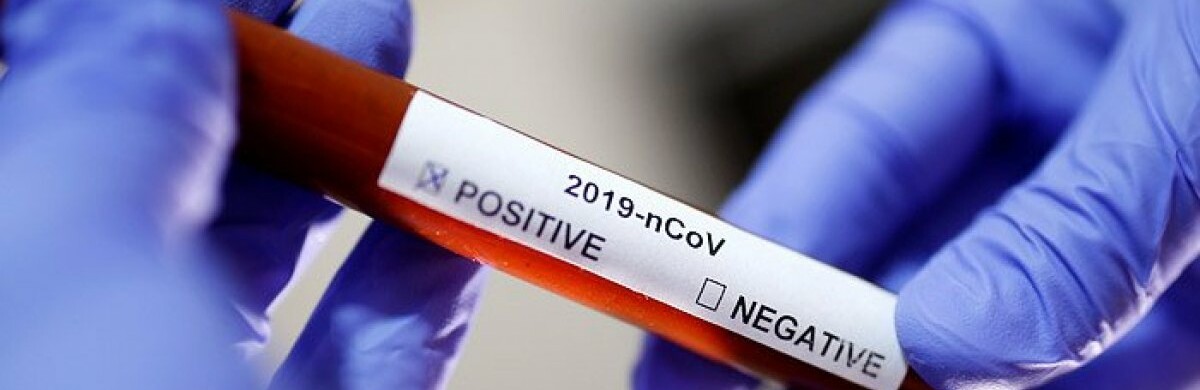 На Днепропетровщине зарегистрировали за сутки 323 новых случая COVID-19