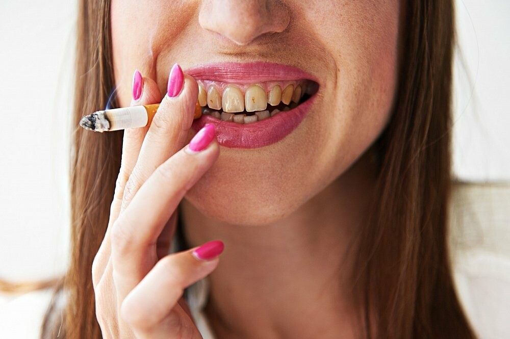 желтизна зубов от никотина у курильщика