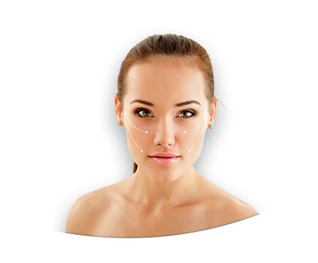 tredlifting-png